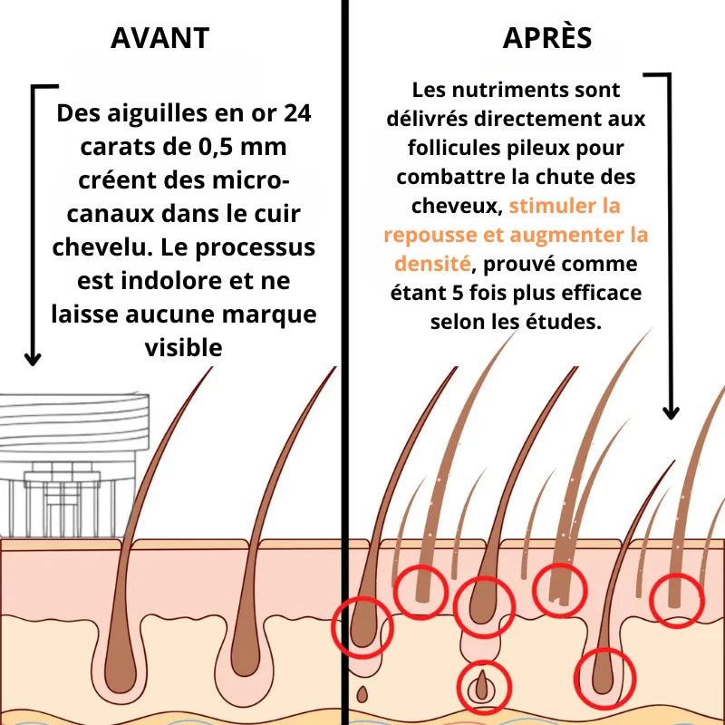 Cure Anti-Chute et Repousse