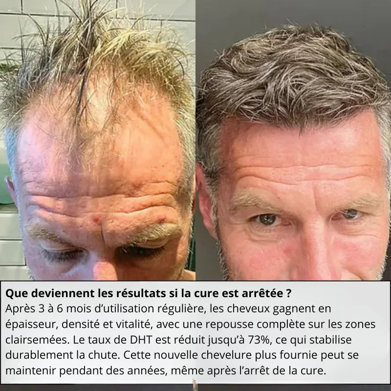 Cure Anti-Chute et Repousse
