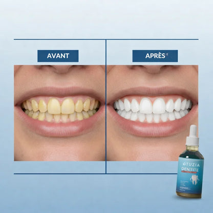 Sérum Réparateur pour l’émail dentaire